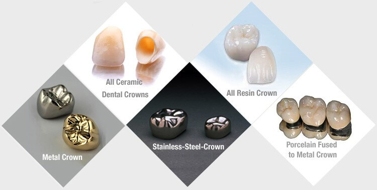 Types Of Dental Crowns