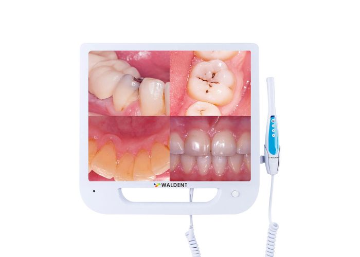 Intra Oral Camera